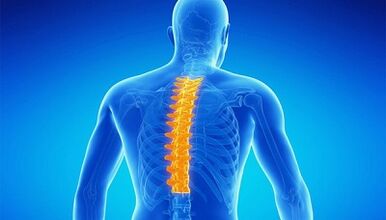 O que é osteocondrose da coluna lombar