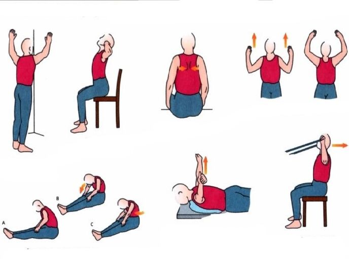 Exercícios físicos no tratamento da osteocondrose